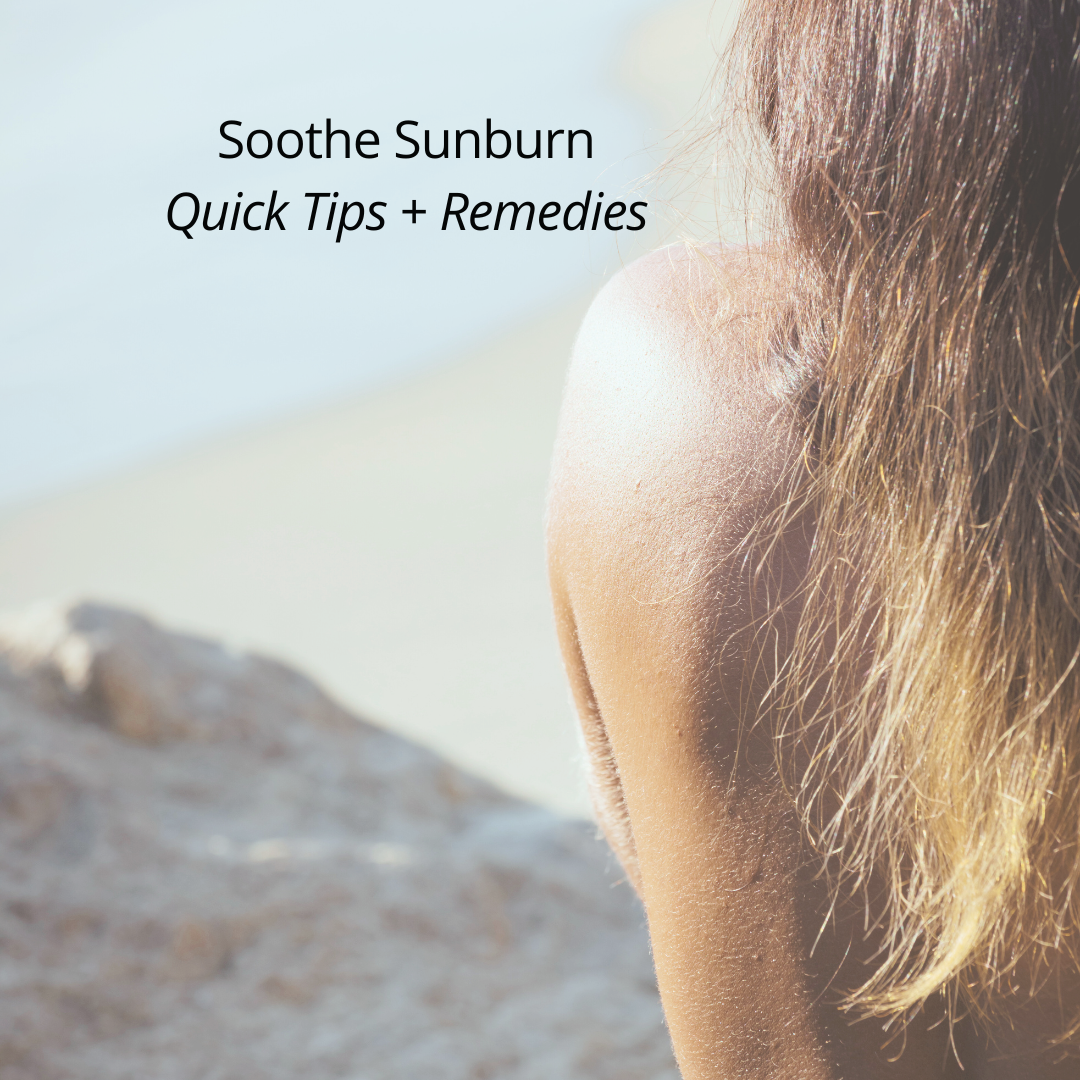 soothe sunburn quick tips and remedies