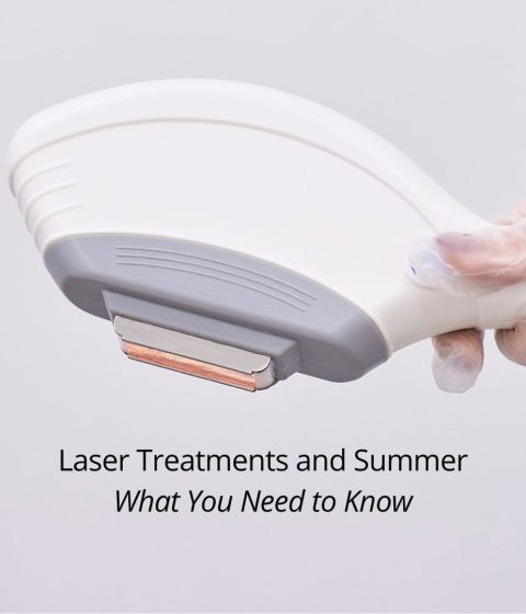 Laser treatments in the summer