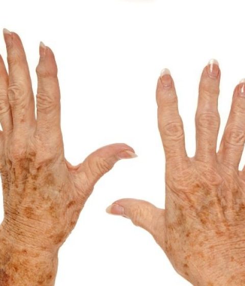 two hands with again spots
